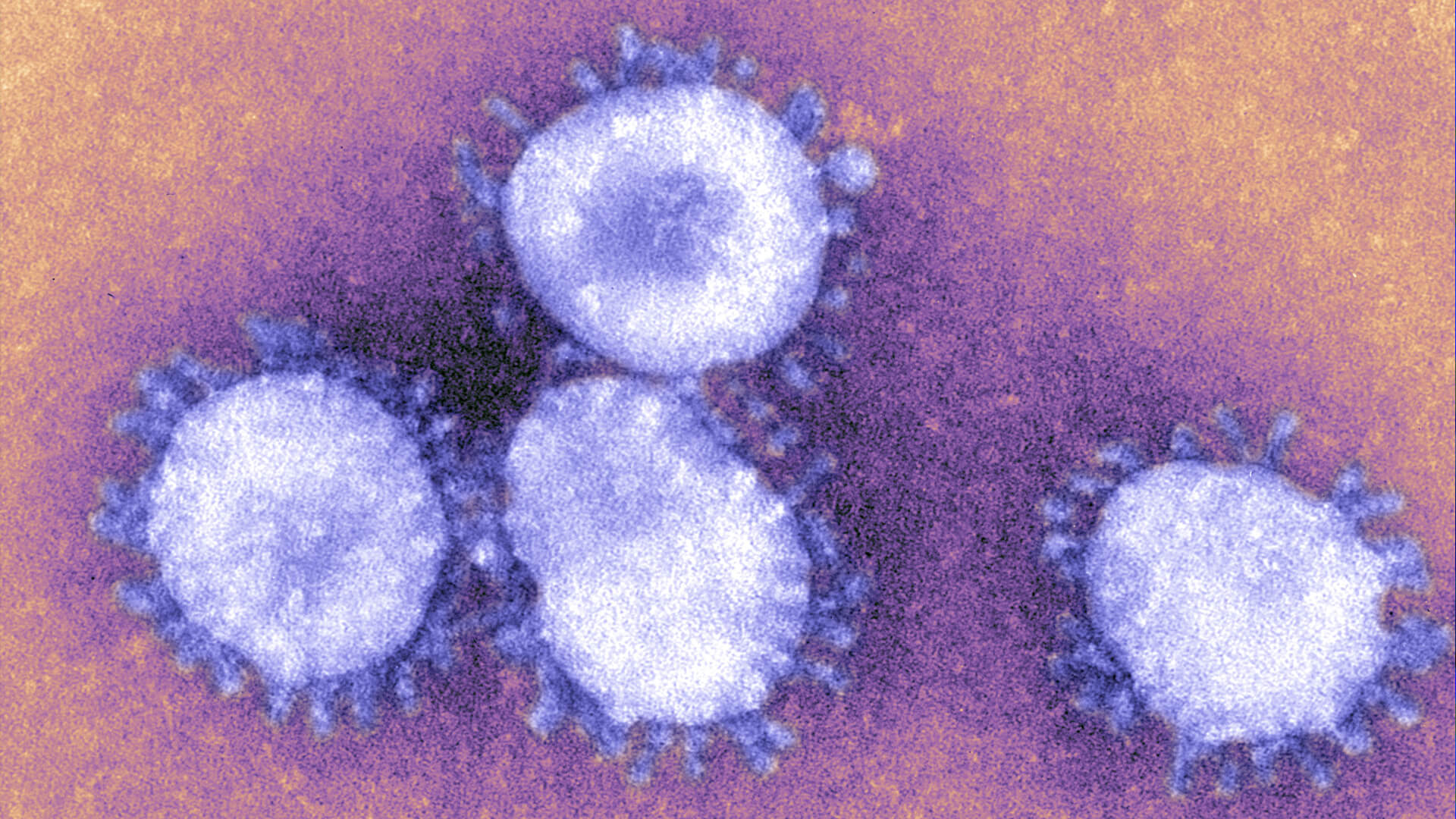 Insights: Global Response to Pandemics